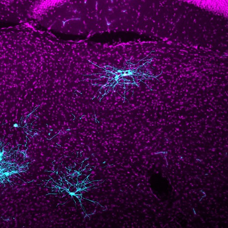 A Salk team builds upon their rabies virus technology to better map neurons across large swaths of the nervous system. In a mouse brain section (thalamus), neurons providing monosynaptic inputs to cortical inhibitory neurons are traced via rabies (blue). Purple counterstaining shows surrounding cellular architecture. (Credit: The Salk Institute)