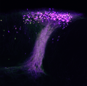 brain cells (purple) actively involved in long-term memory of a specific scent