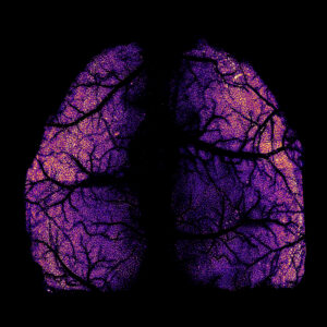 Visualizing individual cells (orange) across a whole cortex of living mouse (purple) 